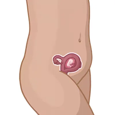 Magen der einer frau mit einem kleinen pflaster darauf.
