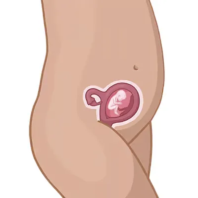 Magen ein mit einem kleinen int darin.